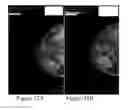 Fig. 31 - Methods of reducing mammographic breast density and/or breast cancer risk