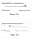 Fig. 32 - Methods of reducing mammographic breast density and/or breast cancer risk