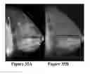 Fig. 34 - Methods of reducing mammographic breast density and/or breast cancer risk