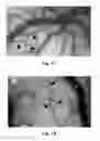 Fig. 02 - NEUROPROTECTIVE COMPOSITION, PREPARATION PROCESS THEREOF AND MEDICAL USES THEREOF