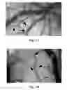 Fig. 02 - NEUROPROTECTIVE COMPOSITION, PREPARATION PROCESS THEREOF AND MEDICAL USES THEREOF