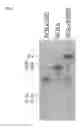 Fig. 04 - Recombinant virus with diminished latency and methods of using same