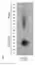 Fig. 09 - Recombinant virus with diminished latency and methods of using same