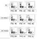 Fig. 07 - Methods and compositions for inhibiting Akt3
