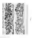 Fig. 08 - Moldable bone graft compositions