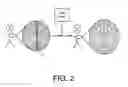 Fig. 03 - COLLECTION OF AMNIOTIC FLUID FOR WOUND HEALING