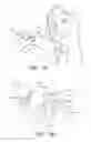 Fig. 12 - Reduced pressure therapy apparatuses and methods of using same