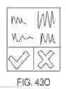 Fig. 103 - Devices, methods and systems for wireless control of medical devices