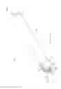 Fig. 29 - Automatic injection device for administration of high viscosity medication