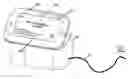 Fig. 01 - Methods and Systems for the Treatment of Sleep Apnea