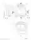 Fig. 02 - Mask bead for a patient interface