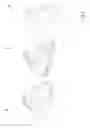 Fig. 04 - Mask bead for a patient interface