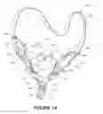 Fig. 02 - Deformable insert for low pressure patient interface