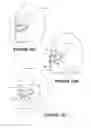 Fig. 06 - Deformable insert for low pressure patient interface