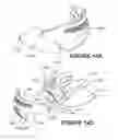 Fig. 32 - Deformable insert for low pressure patient interface