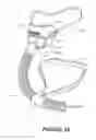 Fig. 37 - Deformable insert for low pressure patient interface