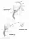 Fig. 45 - Deformable insert for low pressure patient interface