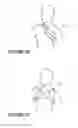 Fig. 48 - Deformable insert for low pressure patient interface