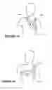 Fig. 50 - Deformable insert for low pressure patient interface