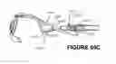 Fig. 69 - Deformable insert for low pressure patient interface