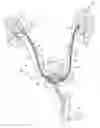 Fig. 01 - Systems and methods for inducing negative pressure in a portion of a urinary tract of a patient
