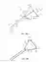 Fig. 40 - Systems and methods for inducing negative pressure in a portion of a urinary tract of a patient