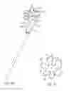 Fig. 53 - Systems and methods for inducing negative pressure in a portion of a urinary tract of a patient
