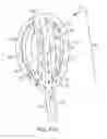 Fig. 63 - Systems and methods for inducing negative pressure in a portion of a urinary tract of a patient