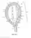 Fig. 65 - Systems and methods for inducing negative pressure in a portion of a urinary tract of a patient