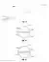 Fig. 03 - Catheter having an expandable lumen and method of manufacture