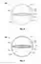 Fig. 04 - Catheter having an expandable lumen and method of manufacture