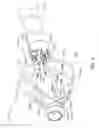Fig. 04 - Tissue retraction system for performing minimally invasive procedures