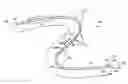 Fig. 01 - MRI compatible interventional wireguide