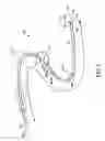 Fig. 02 - MRI compatible interventional wireguide