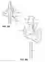 Fig. 09 - Vacuum assisted percutaneous appliance