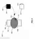 Fig. 03 - Compact muscle stimulator