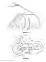 Fig. 07 - Vestibular stimulation device