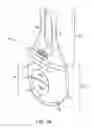 Fig. 02 - NASAL STIMULATION DEVICES AND METHODS