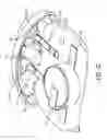 Fig. 09 - NASAL STIMULATION DEVICES AND METHODS
