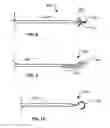 Fig. 04 - Devices and methods for treating tinnitus using electrical stimulation