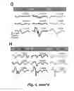 Fig. 09 - Engaging the cervical spinal cord circuitry to re-enable volitional control of hand function in tetraplegic subjects