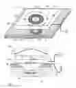 Fig. 01 - Centering kit for aligning an external element with respect to an implanted medical device and corresponding method