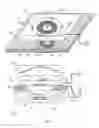 Fig. 02 - Centering kit for aligning an external element with respect to an implanted medical device and corresponding method