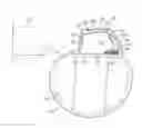 Fig. 01 - Inverted E-antenna for implantable medical devices