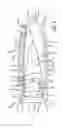 Fig. 04 - Unitarily formed expandable spinal implant and method of manufacturing and implanting same