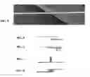Fig. 03 - Liquid-impermeable stitching method for seam of vapor-permeable virus-barrier fabric