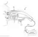Fig. 01 - Charging plug for an electrically driven vehicle