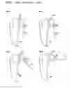 Fig. 09 - Plastic container body and container closure and carry handle grip / container leverage opening tool assembly