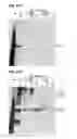Fig. 48 - Compositions containing HC-HA/PTX3 complexes and methods of use thereof