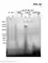 Fig. 49 - Compositions containing HC-HA/PTX3 complexes and methods of use thereof